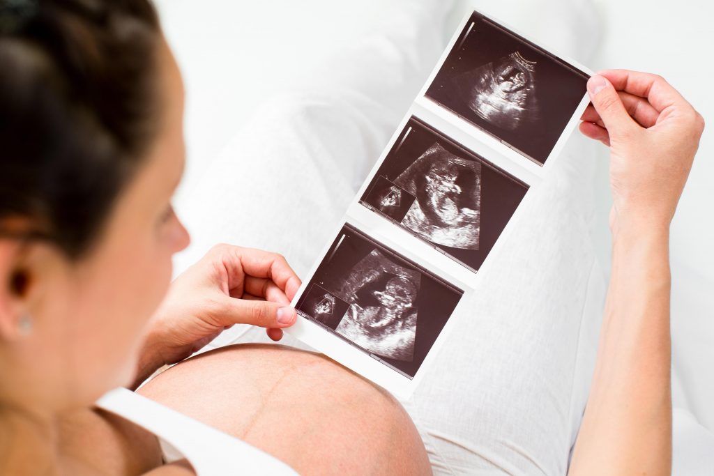 ultraschalluntersuchung während der Schwangerschaft